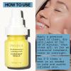 imagePacifica Stress Rehab Redness ampamp Pore Clarifying Face Mask Niacinamide ampamp Caffeine Facial Mask for Redness Relief Pore Minimizer for Oily Skin Clean Beauty Vegan ampamp CrueltyFree 2 Fl OzAzelaic Acid  Turmeric
